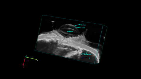 Mouse eye scanned using the UHF71x transducer in 3D